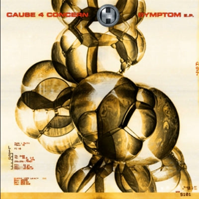 CAUSE 4 CONCERN - Symptom EP