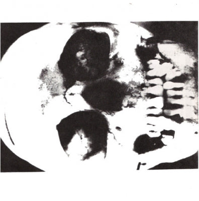 CHARRED REMAINS A·K·A MAN IS THE BASTARD - Abundance Of Guns