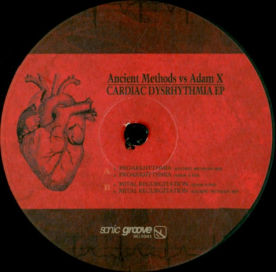 ANCIENT METHODS VS. ADAM X - Cardiac Dysrhythmia