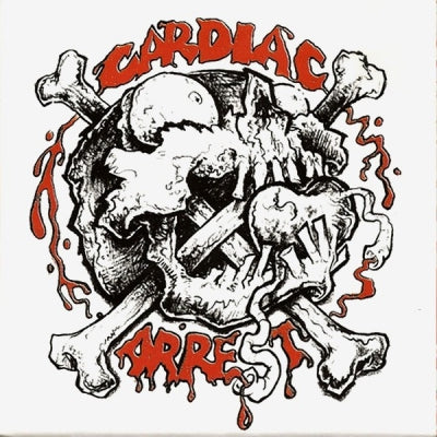 CARDIAC ARREST - Cardiac Arrest